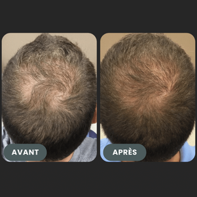 Folixir - Votre allié contre la perte de cheveux
