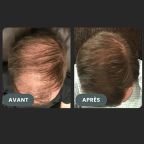 Folixir - Votre allié contre la perte de cheveux