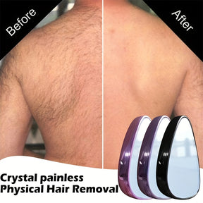 Gomme à Cheveux en Cristal – Épilation Physique Indolore