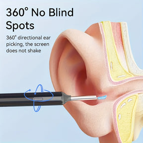 Nettoyeur d’Oreille Intelligent Sans Fil – Otoscope HD 1080P avec Caméra et LED